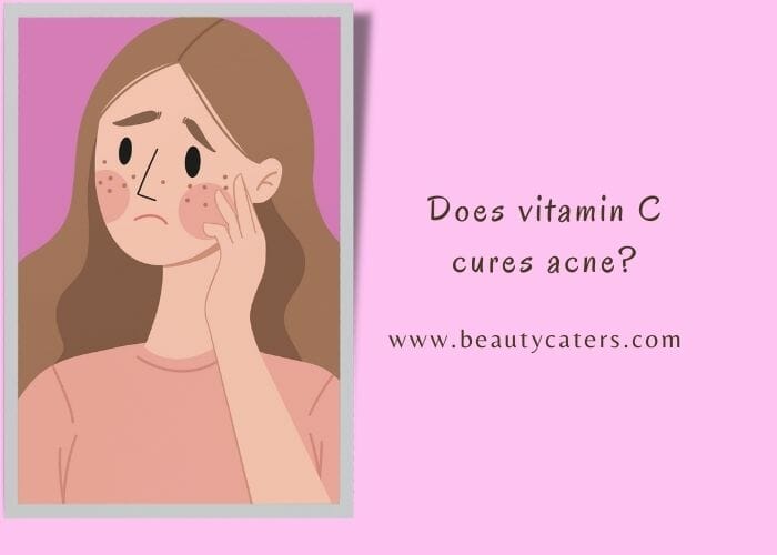 Is Vitamin C Or E Better For Acne Scars