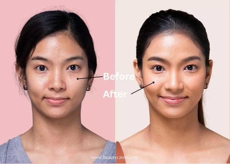 niacinamide before and after introducing to skincare